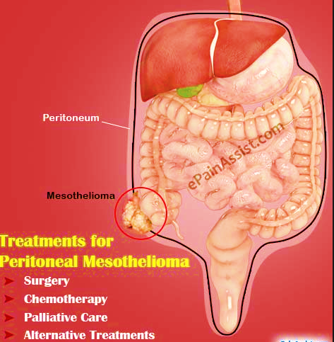 mesothelioma scrotal pathology