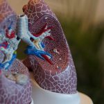 Is It Lung Cancer? What Are 3 Signs of Lung Cancer? 