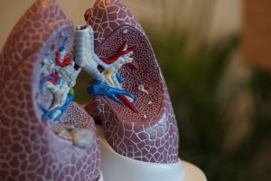 Is It Lung Cancer? What Are 3 Signs of Lung Cancer? 